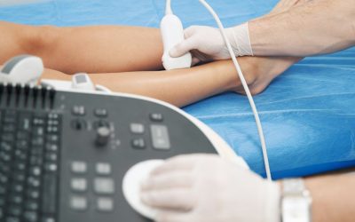 Ecodoppler: Diagnosi Cardiovascolare Rapida e Sicura a Più Salute