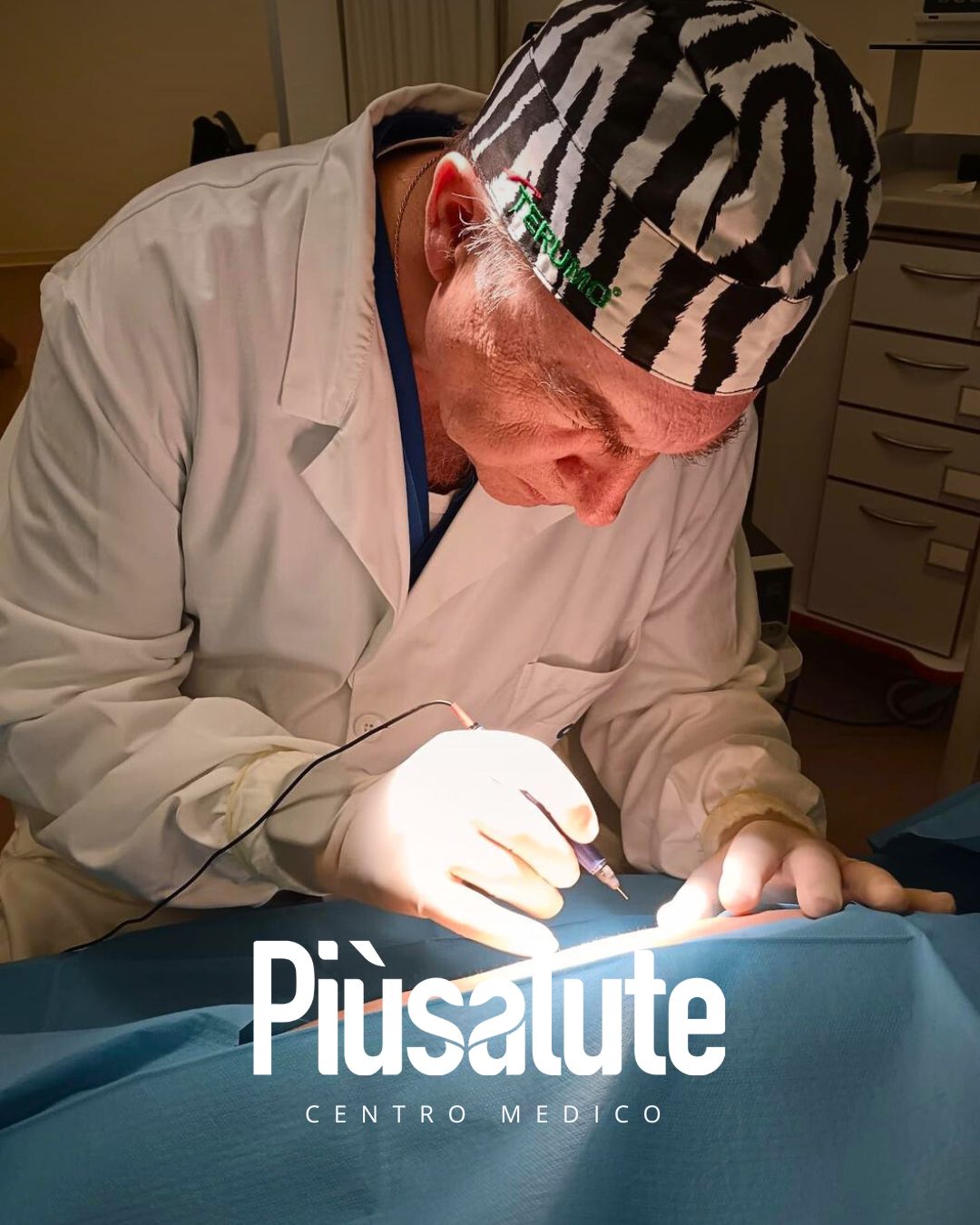 Radio Frequenza Skin Therapy per le vene di ragno